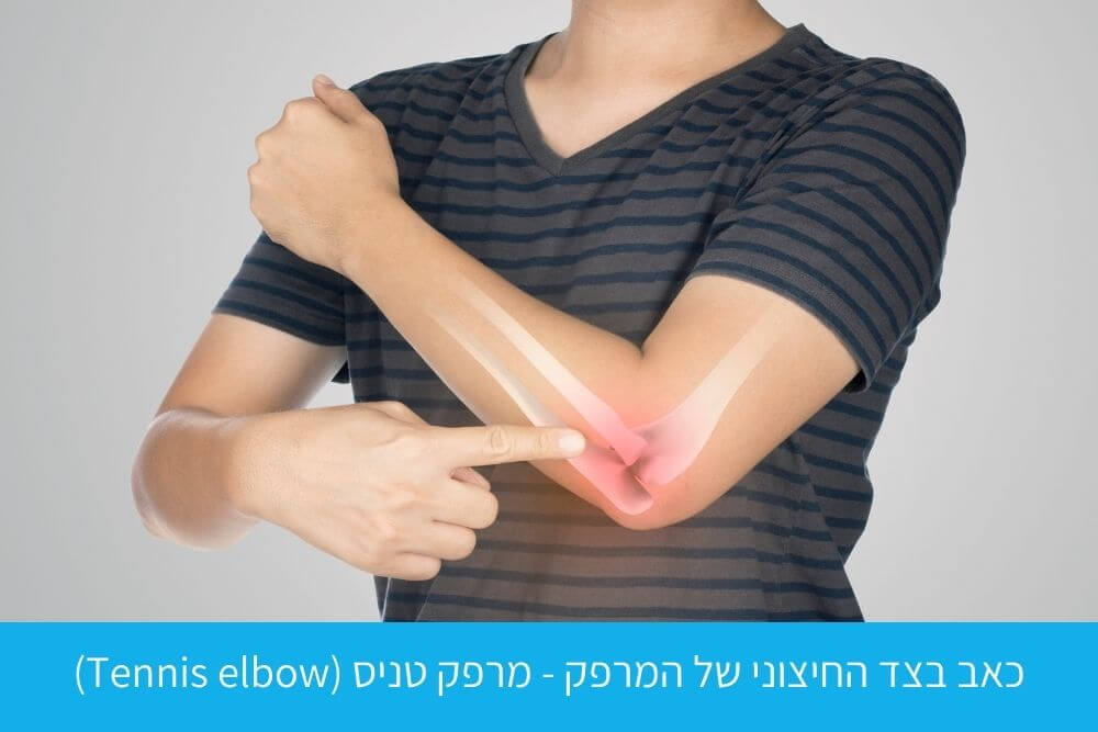 אבחון כאב בצד החיצוני של המרפק - מרפק טניס (Tennis elbow)